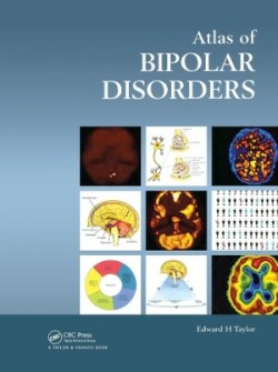 Atlas of Bipolar Disorders