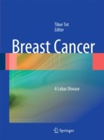 Breast Cancer