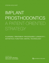 Implant Prosthodontics : A Patient-Oriented Strategy