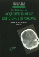 Radiology of Acquired Immune Deficiency Syndrome