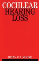 Cochlear Hearing Loss