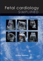 Fetal Cardiology Simplified