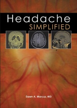 Headache Simplified