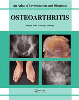 Oesteoarthritis