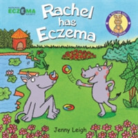 Rachel has Eczema