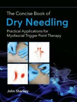 Concise Book of Dry Needling