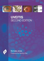 Uveitis, 2nd rev ed.
