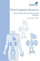 Pelvic Congestion Syndrome - Chronic Pelvic Pain and Pelvic Venous Disorders