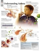 Understanding Asthma Laminated Poster