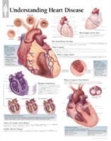 Understanding Heart Disease Laminated Poster