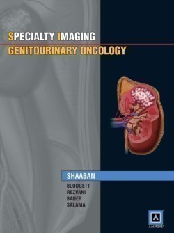 Specialty Imaging: Genitourinary Oncology