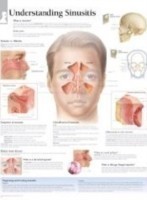 Understanding Sinusitis Paper Poster