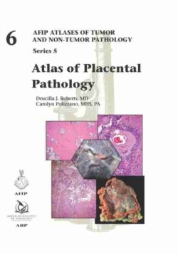 Atlas of Placental Pathology AFIP