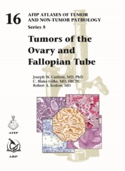 AFIP Tumors of the Ovary and Fallopian Tube, 16