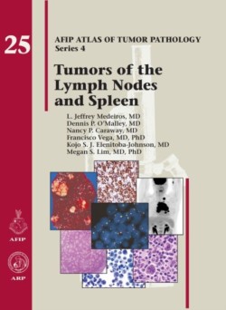 AFIP Tumors of the Lymph Node and Spleen