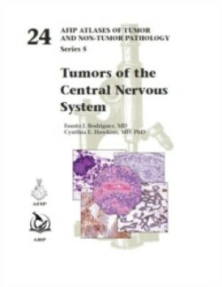 AFIP Tumors of the Central Nervous System, 24