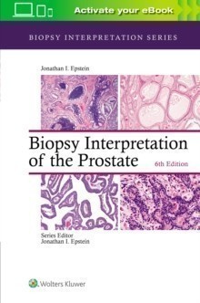 Biopsy Interpretation of the Prostate, 6th Ed.