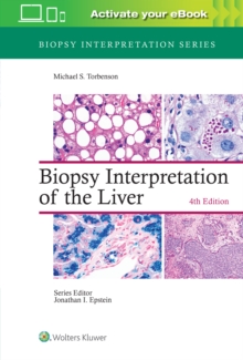 Biopsy Interpretation of the Liver