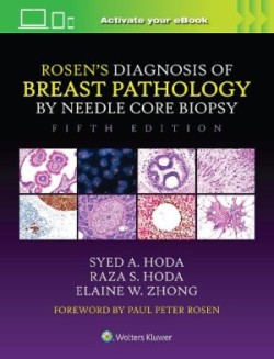 Rosen's Diagnosis of Breast Pathology by Needle Core Biopsy, 5th ed.