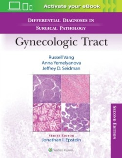 Differential Diagnoses in Surgical Pathology: Gynecologic Tract, 2nd ed.