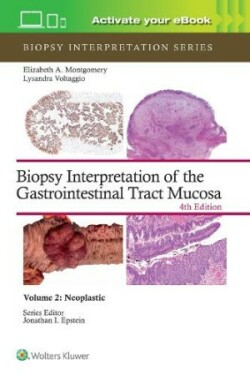 Biopsy Interpretation of the Gastrointestinal Tract Mucosa Volume 2