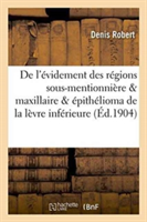 de l'Évidement Des Régions Sous-Mentionnière & Maxillaire Dans l'Épithélioma de la Lèvre Inférieure