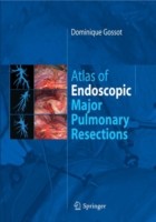 Atlas of Endoscopic Major Pulmonary Resections