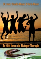 So hilft ihnen die Blutegeltherapie