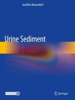 Urine Sediment