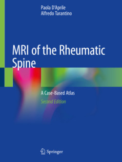 MRI of the Rheumatic Spine