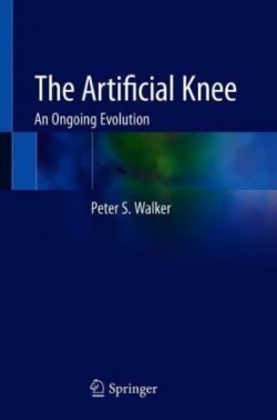 Artificial Knee