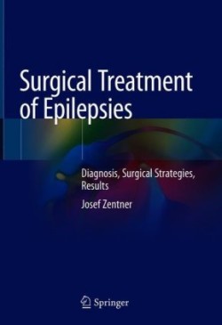 Surgical Treatment of Epilepsies