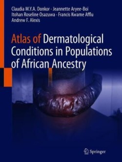 Atlas of Dermatological Conditions in Populations of African Ancestry