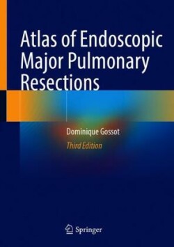 Atlas of Endoscopic Major Pulmonary Resections