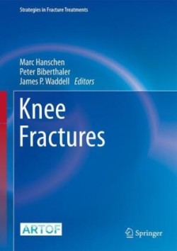 Knee Fractures