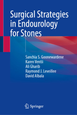 Surgical Strategies in Endourology for Stone Disease