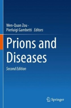 Prions and Diseases