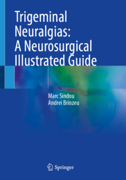 Trigeminal Neuralgias: A Neurosurgical Illustrated Guide