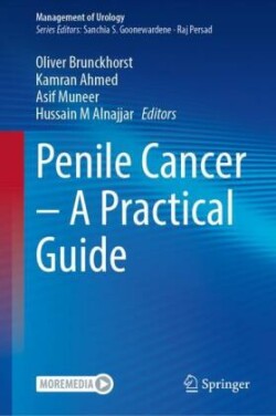 Penile Cancer – A Practical Guide