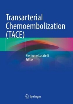 Transarterial Chemoembolization (TACE)