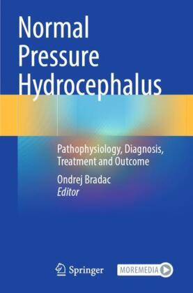 Normal Pressure Hydrocephalus