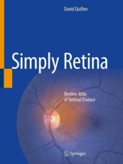 Simply Retina