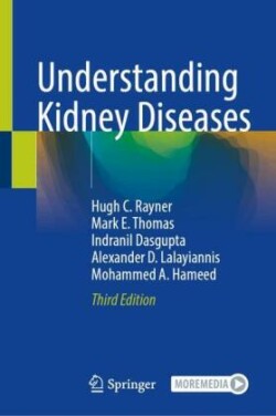 Understanding Kidney Diseases, m. 1 Buch, m. 1 E-Book