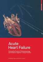 Acute Heart Failure