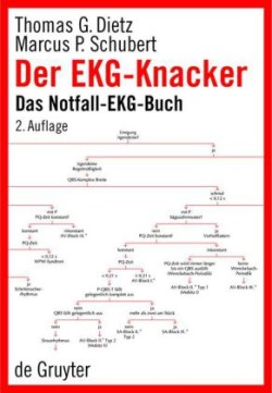 Der EKG-Knacker