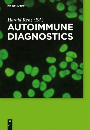 Autoimmune Diagnostics