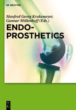 Endoprosthetics