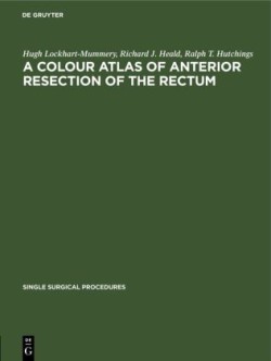 Colour Atlas of Anterior Resection of the Rectum