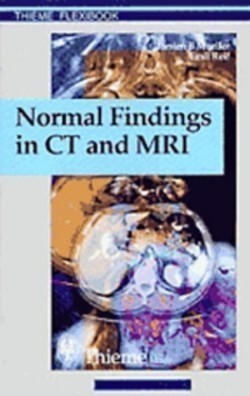 Normmal Findings in Ct and Mri