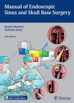 Manual of Endoscopic Sinus and Skull Base Surgery, 2nd ed.